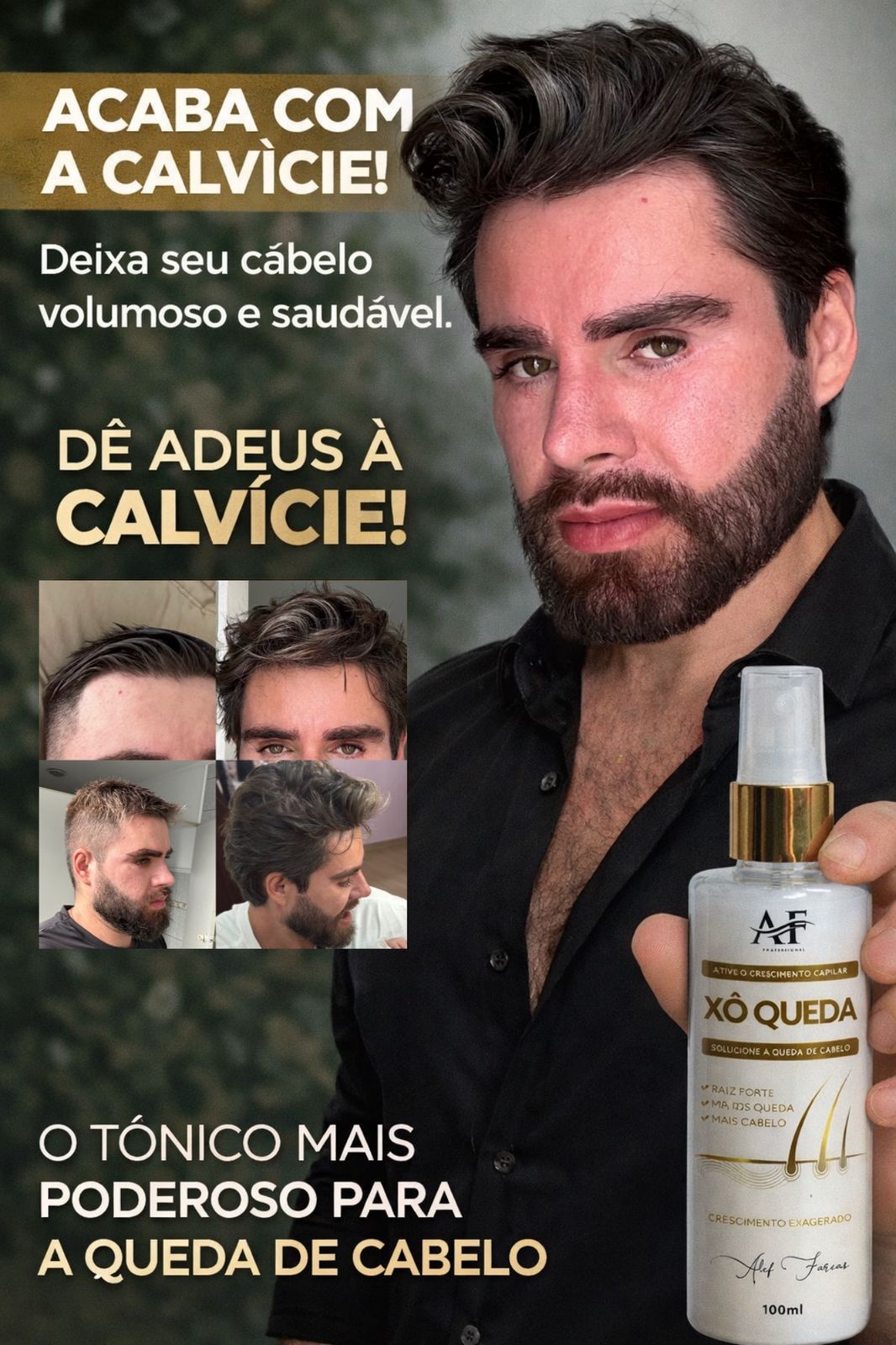 XÔ QUEDA CRESCIMENTO EXAGERADO