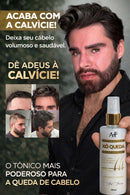 XÔ QUEDA CRESCIMENTO EXAGERADO